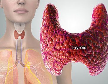 Thyroid Profile (TFT)