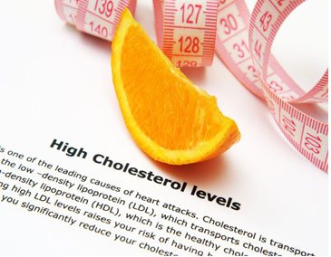 Lipid Profile with Doctor Consultation