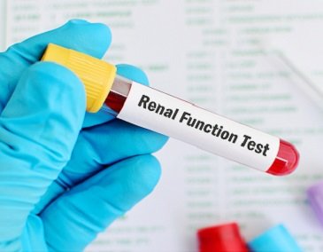 Kidney Profile with Doctor Consultation