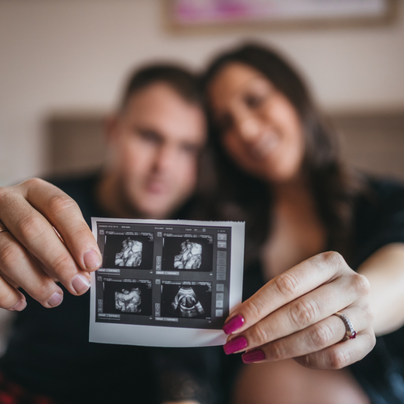 Ultrasound Pregnancy image